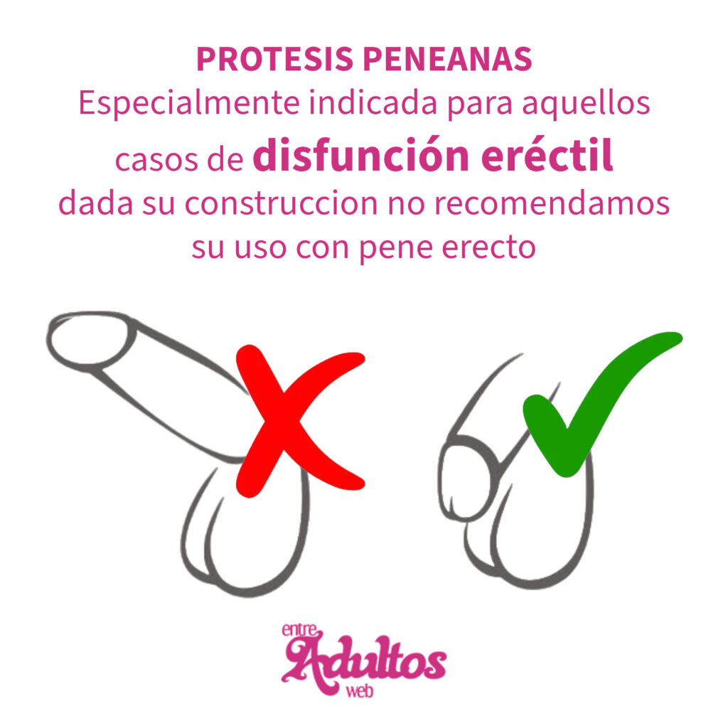 Protesis Peneana Semirigida Pellizcable Mod 1 (20×5cm)